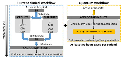 UW Team Creates “One-Stop-Shop” for Stroke Treatment – Department of Radiology – UW–Madison