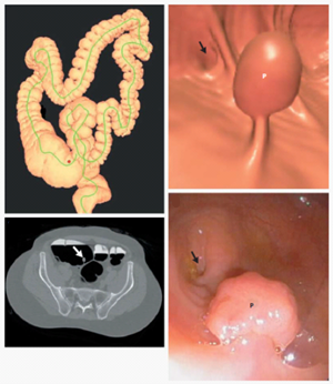 4-part image showing examples of work from the CT research group