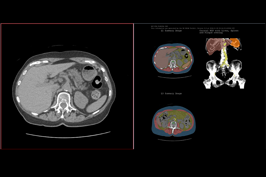 Perry Pickhardt and John Garrett among finalists for 2024 WARF Innovation Awards