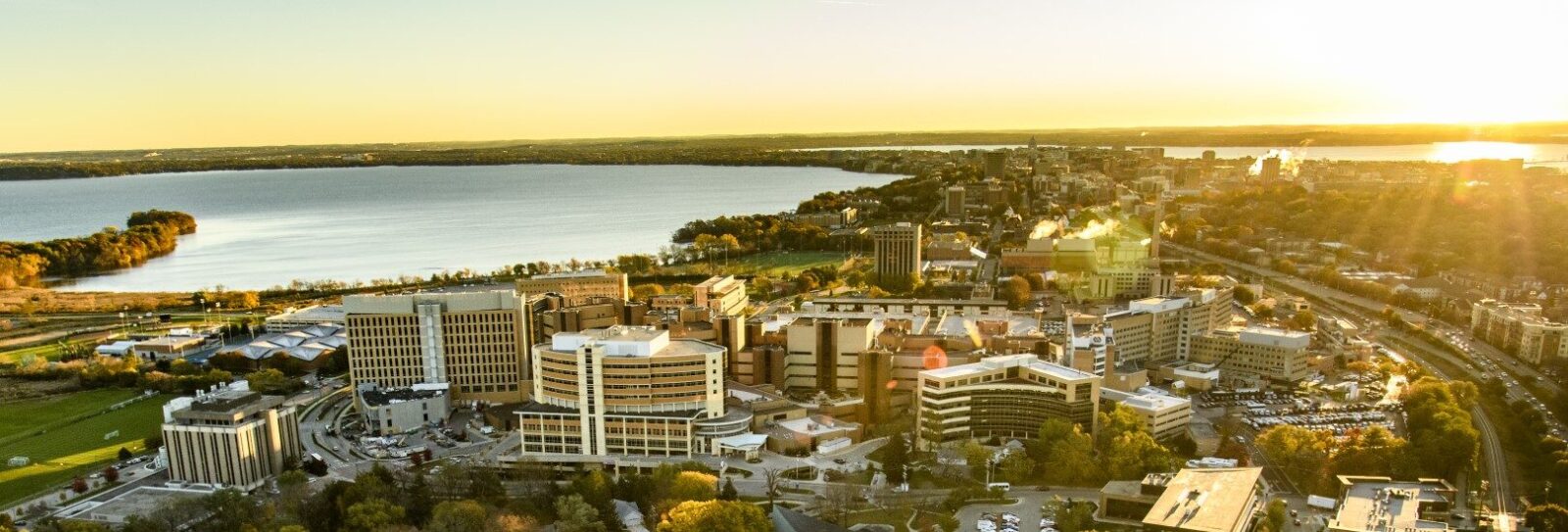 Aerial view of the UW West Campus featuring the University Hospital and a large lake in the background.