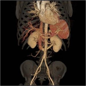 Abdominal imaging example