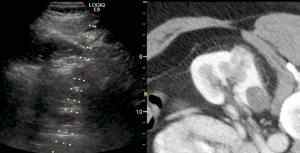 Abdominal imaging example