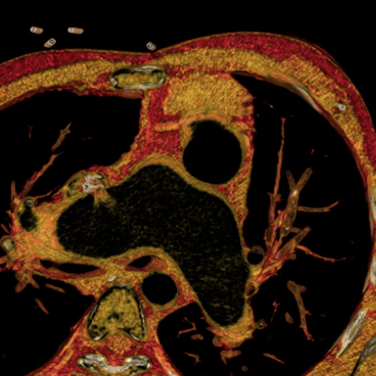 Cardiovascular image example