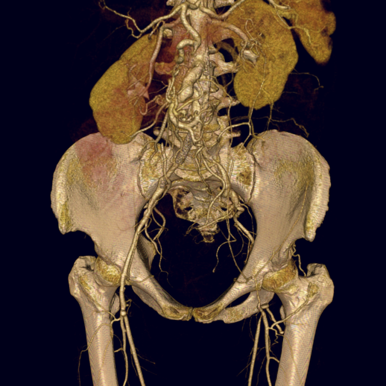Cardiovascular image example