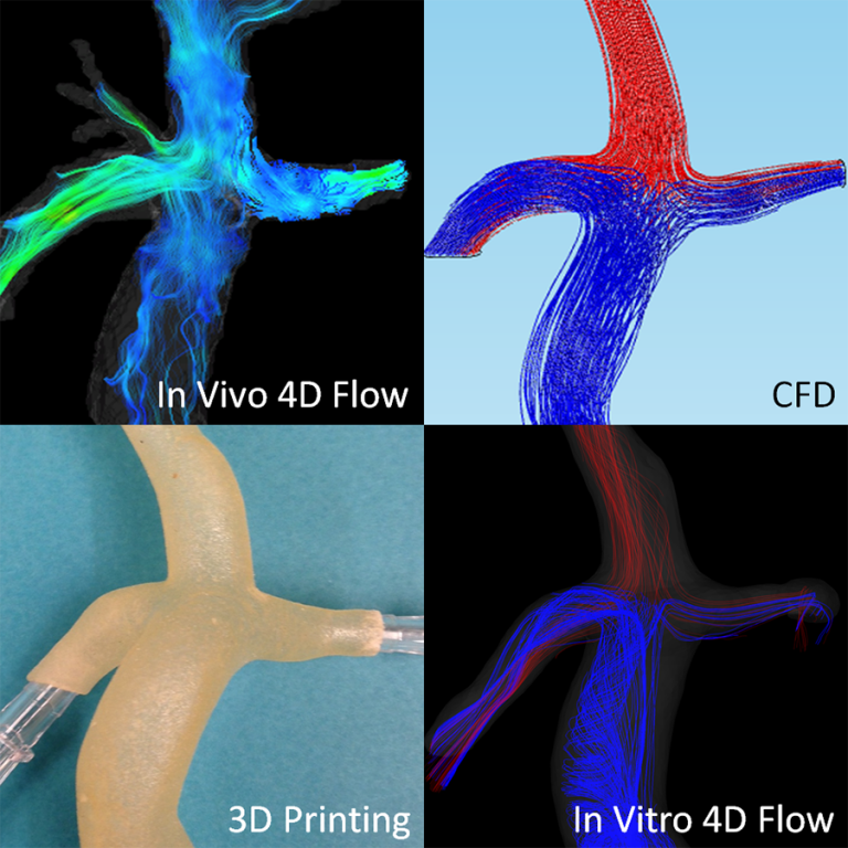 Four cardiovascular imaging examples: In Vivo 4D flow, CFD, 3D Printing, and In vitro 4D flow
