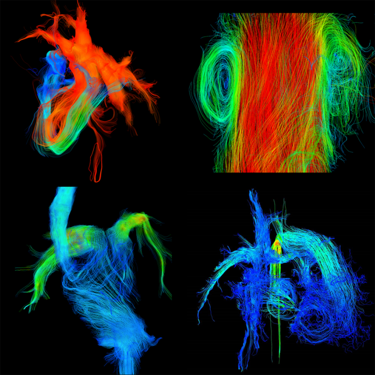 Cardiovascular imaging Flow CMR