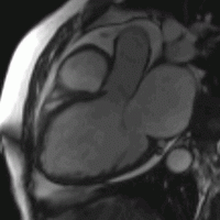 Cardiovascular image example