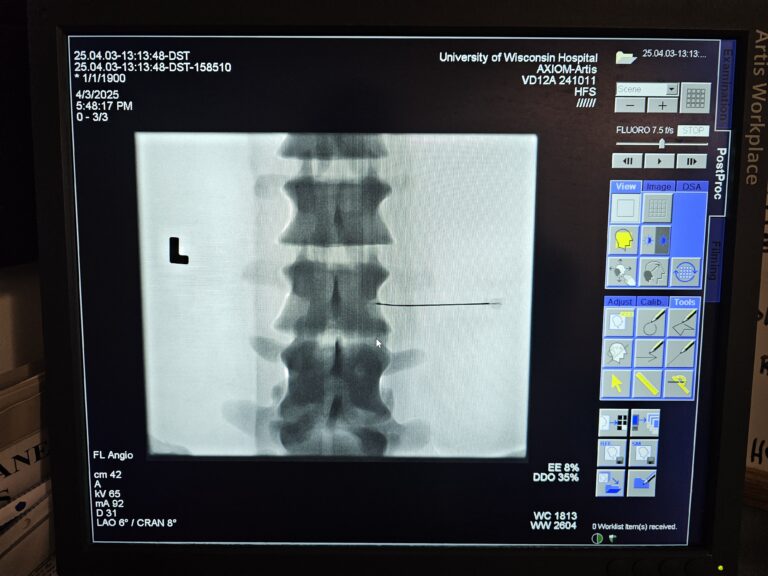 A scan from the spine intervention station.