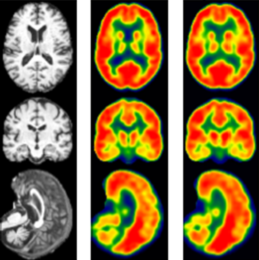 3 column layouts of brain scans
